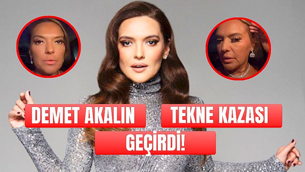 Demet Akalın tekne kazası geçirdi.. 