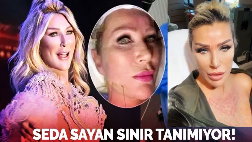 Dekolte bölgesine 'sünnet derisi' enjekte ettiren Seda Sayan yaşadığı değişimi anlattı!