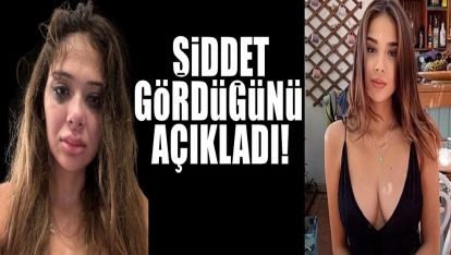 Sosyal medya fenomeni Merve Taşkın sevgilisinden gördüğü şiddeti paylaştı!